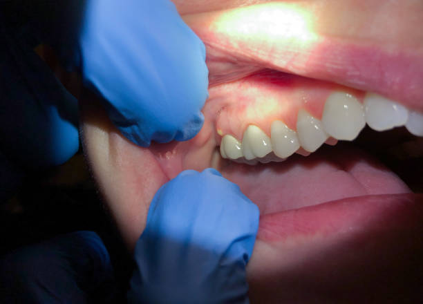 Best Emergency Dental Extractions in Greenback, TN